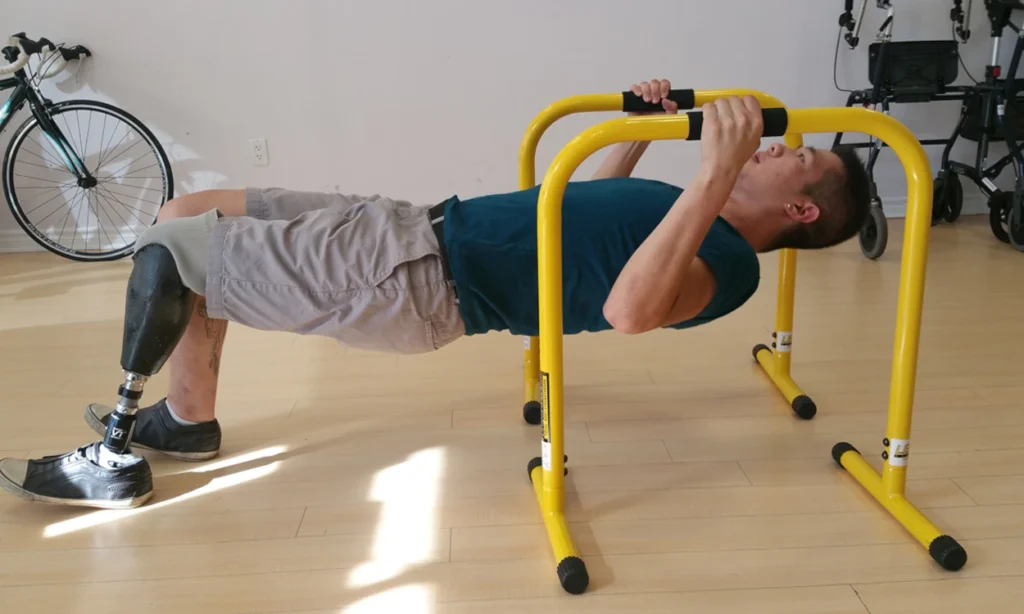 Neurocore physiotherapy - amputee rehabilitation